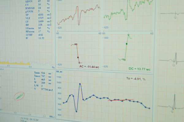 EKG zapis obremenitvenega testiranja na kolesu, cikloergometrija.